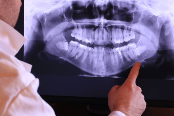 Best Cracked Tooth Emergency Dentist  in Stratford, CA